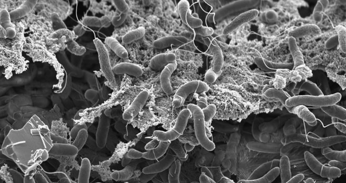 Salud P&uacute;blica vigila a dos con sospecha de c&oacute;lera